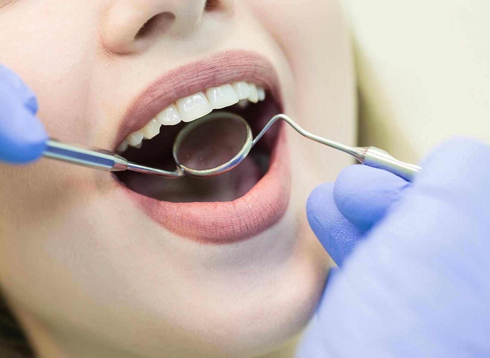 6 Types Of Dental Restoration