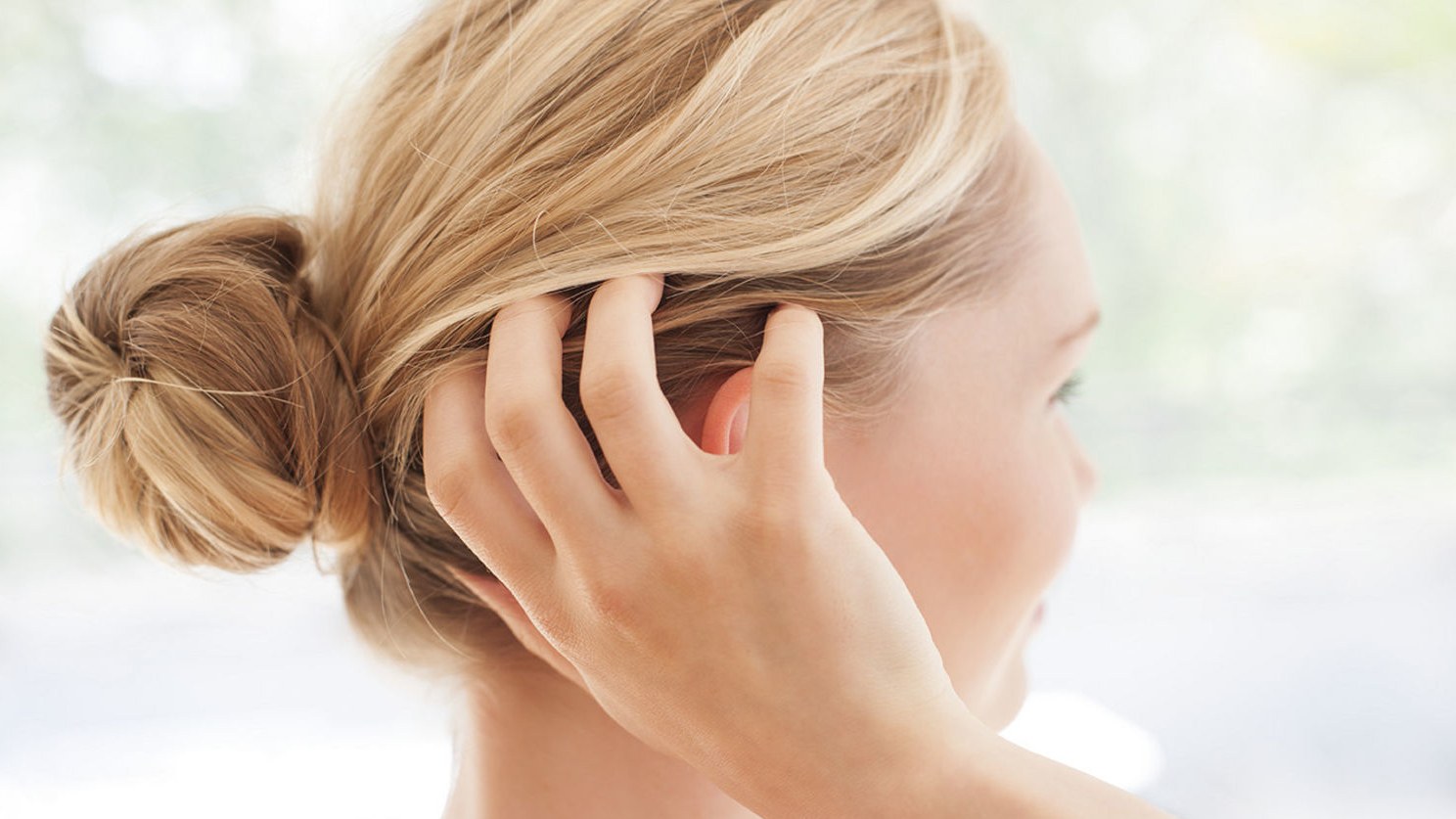 What Is Itchy Scalp And What Can You Do About It?